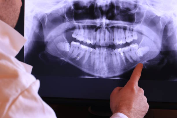 Best Broken or Chipped Tooth Repair in Chesnut Hill, PA